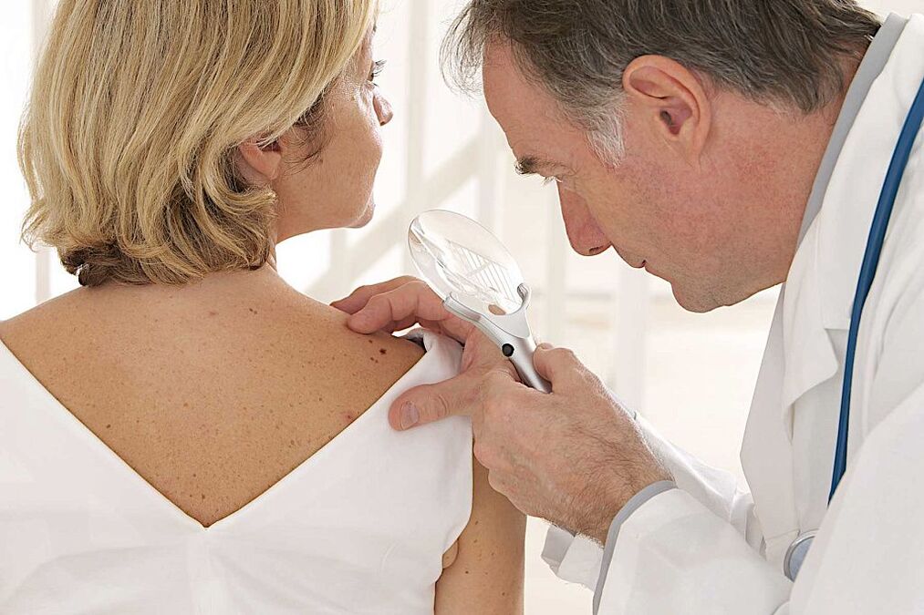 diagnosis of human papilloma virus